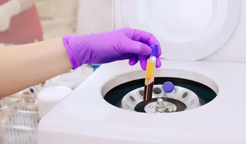 PRP Tedavisi: Doğal Yenilenmenin Gücü